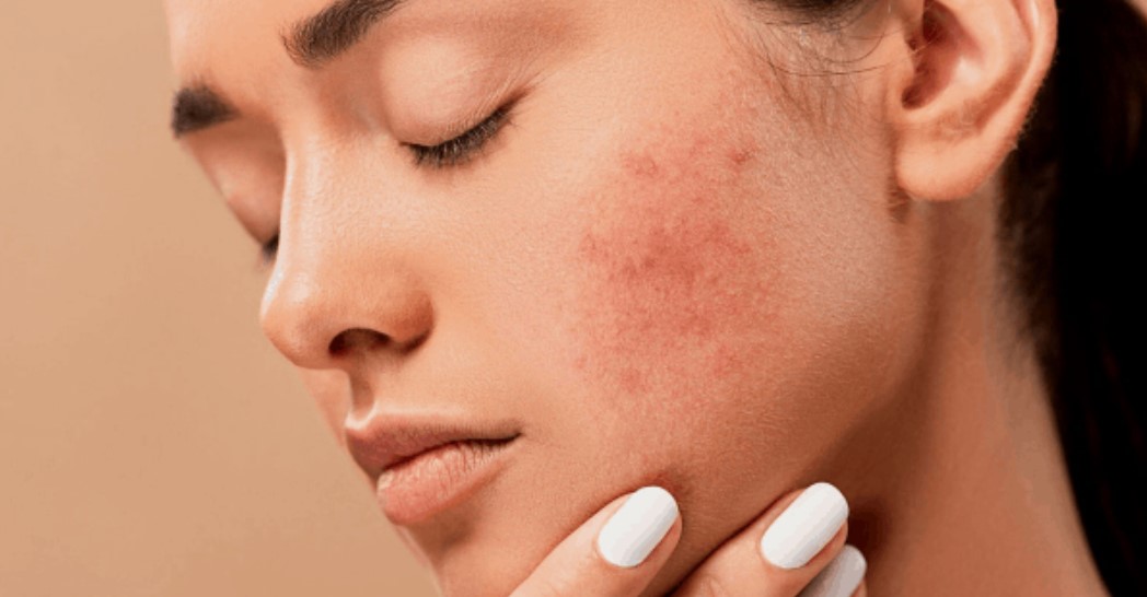 The Most Common Skin Problems that Would Need the Help of a Dermatologist